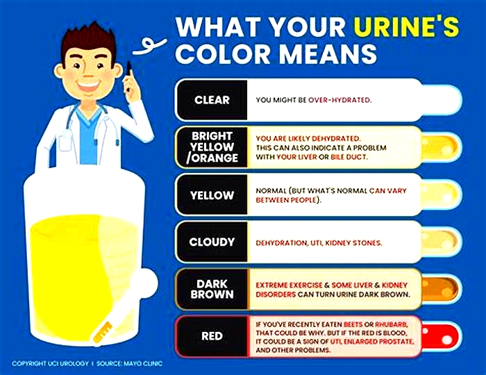 What color is urine when your kidneys are failing?